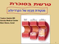 טרשת בסוכרת